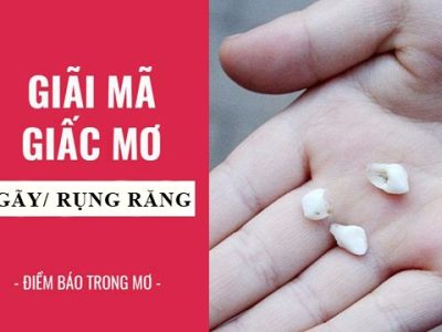 Nằm mơ thấy rụng răng điềm báo gì?