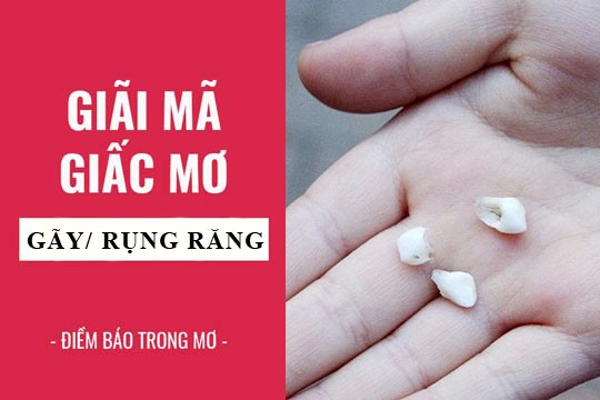 Nằm mơ thấy rụng răng điềm báo gì