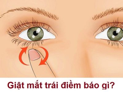 Giật mắt trái là điềm gì?